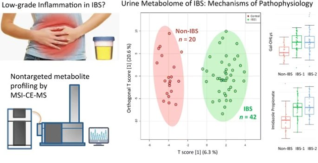 NUOVI BIOMARCATORI PER IL COLON IRRITABILE