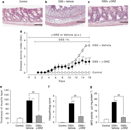 UN AMICO PER L’INTESTINO – GAMMA ORIZANOLO