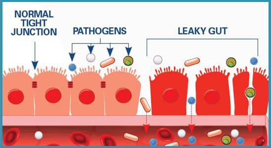 PERMEABILITA’ INTESTINALE – ‘DU TEST IS MEGL CHE UAN’