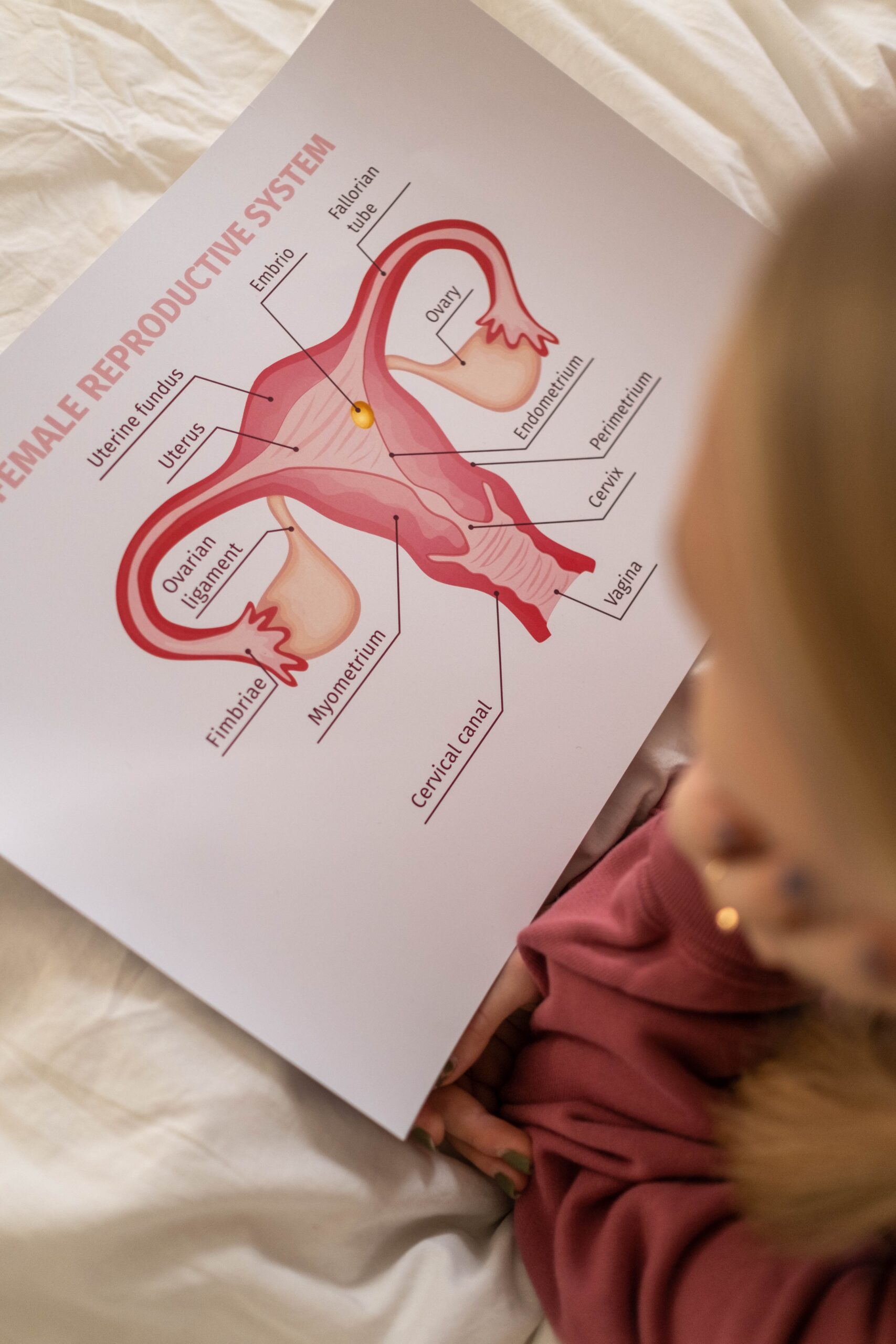 IL MICROBIOTA INFLUENZA IL RISCHIO DI ENDOMETRIOSI